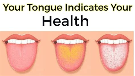 tounge|What Your Tongue Says About Your Health